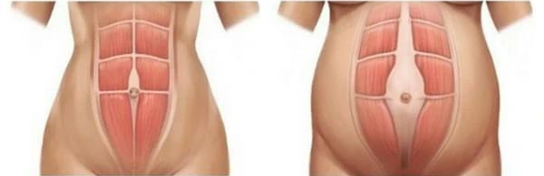 产后抑郁预防_天津康复护理攻略_产后恢复知识