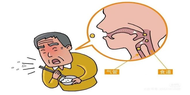 吞咽障碍康复护理_术后康复护理_识别吞咽‮的碍障‬早期‮号信‬
