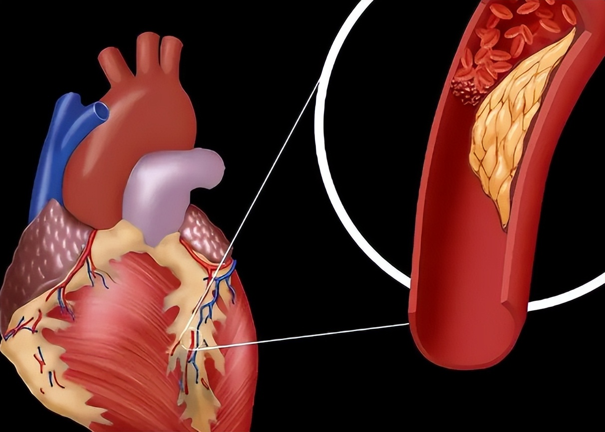 种植牙风险_中老年人种植牙术后护理_天津术后护理新闻